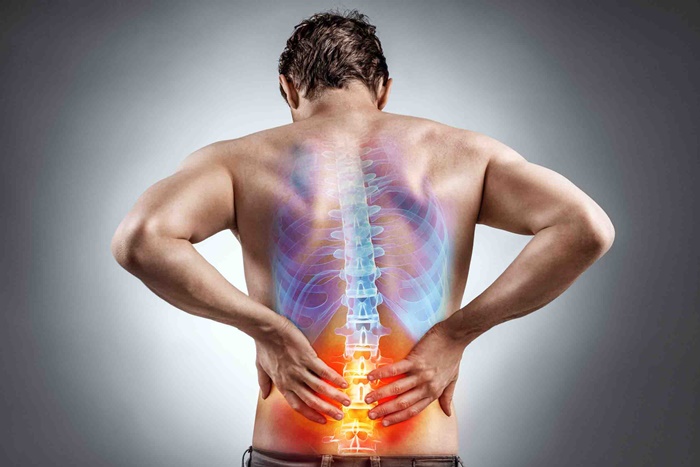 Conheça as 5 principais causas de dores na coluna -